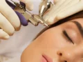 Five Amazing Benefits of Oxygeneo Facials