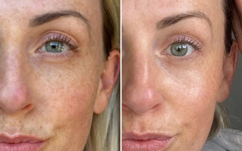 Visualizing the Benefits of Light Therapy