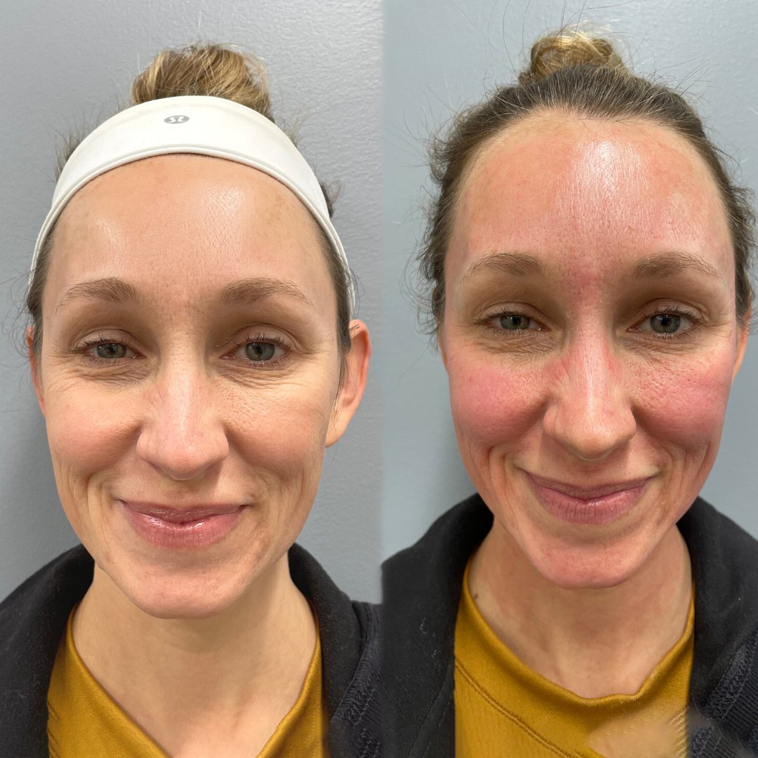 Simple Photo Before and After Skincare Instagram Post