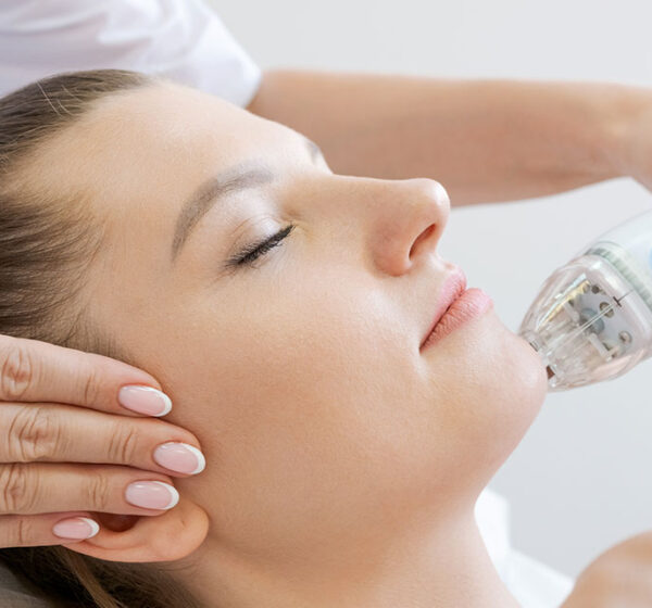 Professional microneedling treatment